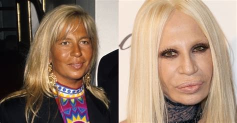 donatella versace antes e depois|Donatella Versace murder.